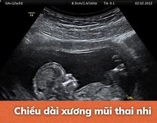 Giảm Thiểu Thai Nhi Có An Toàn Không